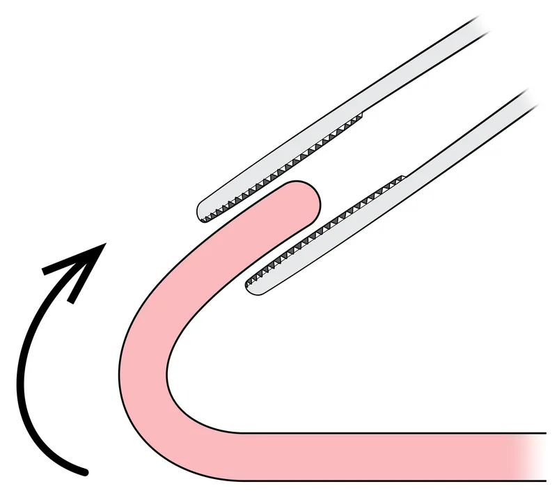 Retracting the edge into position for grasping